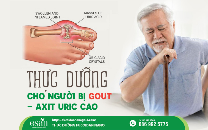 Thực dưỡng cho người bị gout - Giải pháp tự nhiên giúp ổn định axit uric